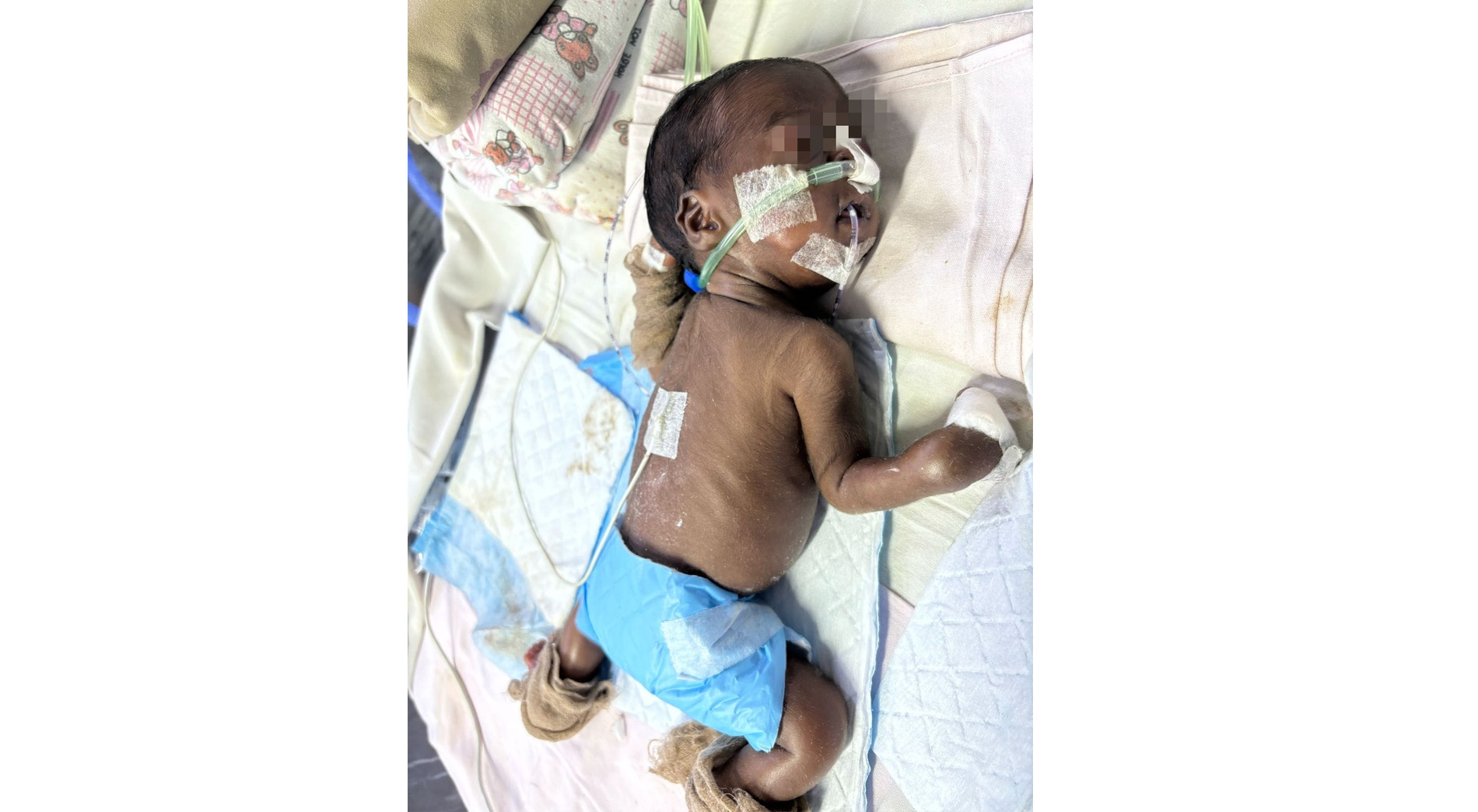 I am B/O Mageshwari Twin – 2 raising fund for my brave little warrior